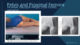 Comprehensive Guide to Pelvis and Proximal Femur X-Ray Techniques and ...