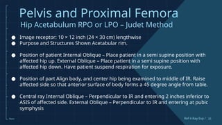 Comprehensive Guide to Pelvis and Proximal Femur X-Ray Techniques and ...