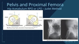 Comprehensive Guide to Pelvis and Proximal Femur X-Ray Techniques and ...