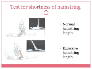 Hamstring Muscle Weakness Testing Pelvis And Thigh 2 | PPT