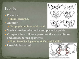  Posterior:
 Ilium, sacrum, SI

 Anterior:
 Symphysis pubis or pubic rami

 Vertically oriented anterior and posterior pelvis

 Complete Pelvic Floor + posterior SI + sacrospinous

and sacrotuberous ligaments
 Post. Sacroiliac ligaments  Vertical Stability

 Unstable Fractures!

 