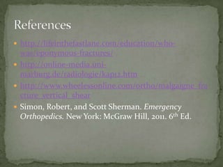  http://lifeinthefastlane.com/education/who-

was/eponymous-fractures/
 http://online-media.unimarburg.de/radiologie/kap12.htm
 http://www.wheelessonline.com/ortho/malgaigne_fra
cture_vertical_shear
 Simon, Robert, and Scott Sherman. Emergency
Orthopedics. New York: McGraw Hill, 2011. 6th Ed.

 
