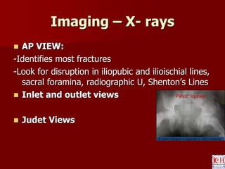 Pelvis acetabulum - anatomy , imaging , classification | PPTX