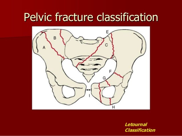 Pelvis acetabulum - anatomy , imaging , classification