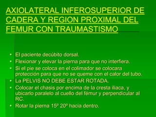 AXIOLATERAL INFEROSUPERIOR DE
CADERA Y REGION PROXIMAL DEL
FEMUR CON TRAUMASTISMO
 El paciente decúbito dorsal.
 Flexionar y elevar la pierna para que no interfiera.
 Si el pie se coloca en el colimador se colocara
protección para que no se queme con el calor del tubo.
 La PELVIS NO DEBE ESTAR ROTADA.
 Colocar el chasis por encima de la cresta iliaca, y
ubicarlo paralelo al cuello del fémur y perpendicular al
RC.
 Rotar la pierna 15º 20º hacia dentro.
 