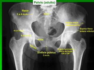 23
Pelvis (adulto)
4 ó 5 m.m.
8 ó 9 m.m.
Sínfisis púbica
3 m.m.
Ilíaco
Pubis
Espina ilíaca
anterosuperior
Espina ilíaca
antero inferior
Sacro3 a 4 m.m.
Ángulo cervicodia-
fisario de Keats
120 a 130°
 