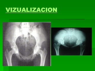 VIZUALIZACION
 