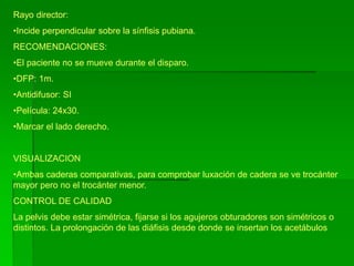 Rayo director:
•Incide perpendicular sobre la sínfisis pubiana.
RECOMENDACIONES:
•El paciente no se mueve durante el disparo.
•DFP: 1m.
•Antidifusor: SI
•Película: 24x30.
•Marcar el lado derecho.
VISUALIZACION
•Ambas caderas comparativas, para comprobar luxación de cadera se ve trocánter
mayor pero no el trocánter menor.
CONTROL DE CALIDAD
La pelvis debe estar simétrica, fijarse si los agujeros obturadores son simétricos o
distintos. La prolongación de las diáfisis desde donde se insertan los acetábulos
 