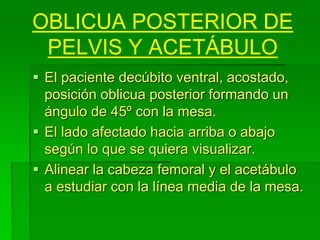 OBLICUA POSTERIOR DE
PELVIS Y ACETÁBULO
 El paciente decúbito ventral, acostado,
posición oblicua posterior formando un
ángulo de 45º con la mesa.
 El lado afectado hacia arriba o abajo
según lo que se quiera visualizar.
 Alinear la cabeza femoral y el acetábulo
a estudiar con la línea media de la mesa.
 