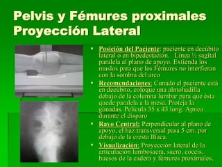 Pelvis y Fémures proximales
Proyección Lateral
 Posición del Paciente: paciente en decúbito
lateral o en bipedestación. Línea ½ sagital
paralela al plano de apoyo. Extienda los
muslos para que los Fémures no interfieran
con la sombra del arco
 Recomendaciones: Cunado el paciente está
en decúbito, coloque una almohadilla
debajo de la columna lumbar para que ésta
quede paralela a la mesa. Proteja la
gónadas. Película 35 x 43 long. Apnea
durante el disparo
 Rayo Central: Perpendicular al plano de
apoyo, el haz transversal pasa 5 cm. por
debajo de la cresta Ilíaca.
 Visualización: Proyección lateral de la
articulación lumbosacra, sacro, coccis,
huesos de la cadera y fémures proximales.
 
