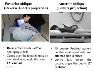 Unaffected Side Radiography Technique of Pelvis & Hip joint | PPTX