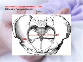 4) Anatomical Transverse Diameter (13 cm)
5) Obstetric Transverse Diameter
ATD
OTD
 