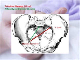 6) Oblique Diameter (12 cm)
7) Sacrotyloid Diameter (9.5 cm)
SI Joint
Iliopubic eminence
 