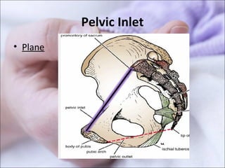 Pelvic Inlet
• Plane
 