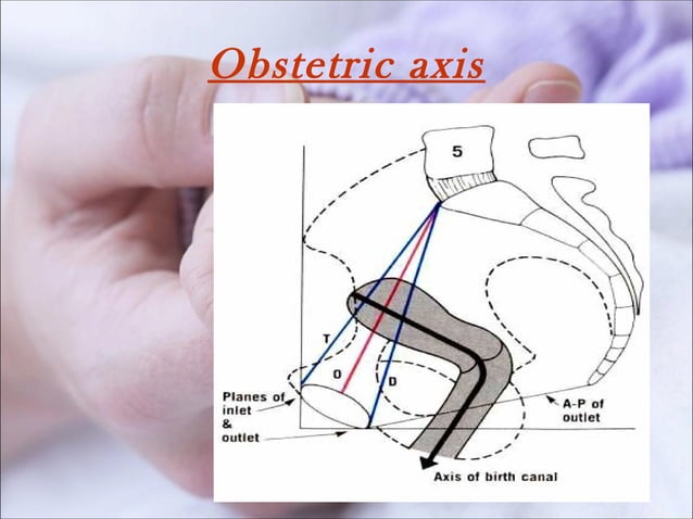 Pelvis and pelvimetry | PPT