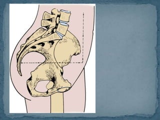  Eje del estrecho
superior se dispone
paralelo al suelo
 Estrecho superior
se dispone hacia
delante
 Ramas inferiores
isquiopubicas se
disponen
horizontales
 