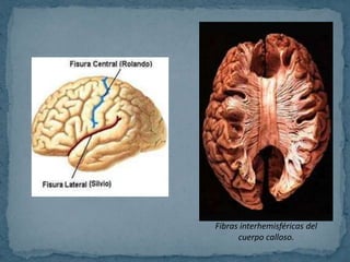 Fibras interhemisféricas del
cuerpo calloso.
 