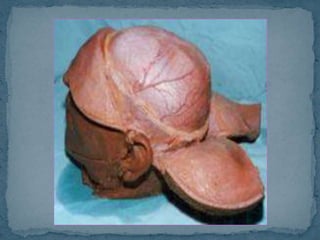 Pelvis, cabeza y cuello