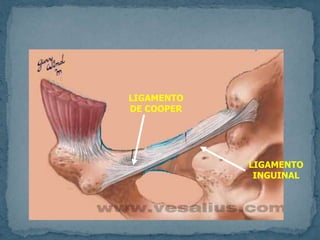 LIGAMENTO
DE COOPER
LIGAMENTO
INGUINAL
 
