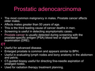 Prostatic adenocarcinoma
• The most common malignancy in males. Prostate cancer affects
older males.
• Affects males greater than 50 years of age.
• This is the third leading cause of cancer deaths in men.
• Screening is useful in detecting asymptomatic cases.
• Prostate cancer is usually detected during screening with the
prostate-specific antigen (PSA) blood test or digital rectal
examination (DRE).
CT
• Useful for advanced disease.
• Enlarged prostate is common and appears similar to BPH.
• Useful in evaluating lymph nodes and bony anatomy in the abdomen
and pelvis.
• CT-guided biopsy useful for directing fine-needle aspiration of
enlarged nodes.
• Used for radiation therapy treatment planning.
 