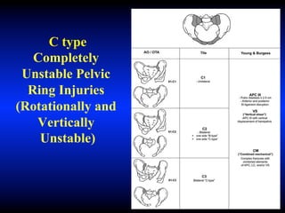 C type
Completely
Unstable Pelvic
Ring Injuries
(Rotationally and
Vertically
Unstable)
 