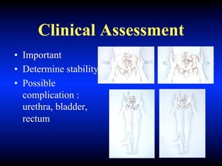 Clinical Assessment
• Important
• Determine stability
• Possible
complication :
urethra, bladder,
rectum
 