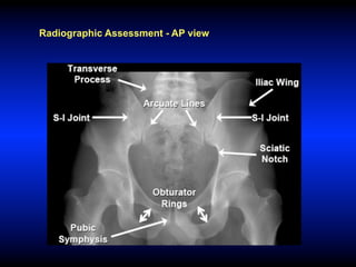 Radiographic Assessment - AP view
 