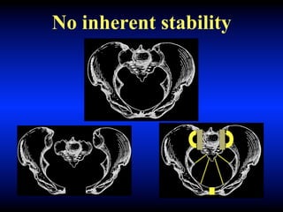 No inherent stability
 