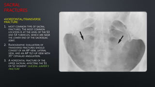 SACRAL
FRACTURES
•HORIZONTAL/TRANSVERSE
FRACTURE:
1.
2.
3.
SUICIDAL JUMPER’S
FRACTURE
 