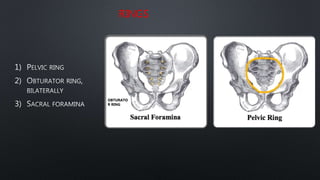 RINGS
1)
2)
3)
OBTURATO
R RING
 