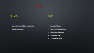 LINES
PELVIS
•
•
HIP
•
•
•
•
•
 