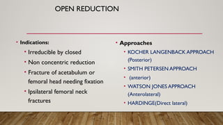 Direct Lateral Harding Approach PELVIS FRACTURES AND HIP DISLOCATIONS.pptx