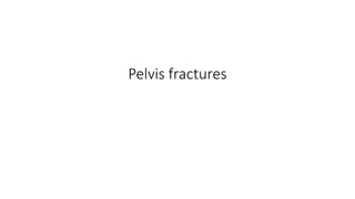 Pelvis fractures
 