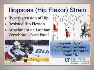 Iliopsoas (Hip Flexor) Strain
• Hyperextension of Hip
• Resisted Hip Flexion
• Attachment on Lumbar
Vertebrae – Back Pain?
Palpable Defect,
Ecchymosis, Swelling,
Gait Changes depend on
Grade I-III
 