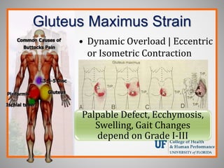 Gluteus Maximus Strain
• Dynamic Overload | Eccentric
or Isometric Contraction
Palpable Defect, Ecchymosis,
Swelling, Gait Changes
depend on Grade I-III
 