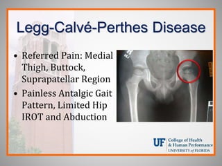 Legg-Calvé-Perthes Disease
• Referred Pain: Medial
Thigh, Buttock,
Suprapatellar Region
• Painless Antalgic Gait
Pattern, Limited Hip
IROT and Abduction
 