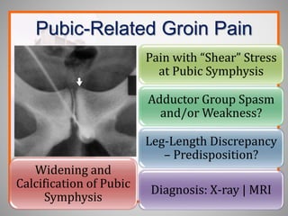 Pubic-Related Groin Pain
Pain with “Shear” Stress
at Pubic Symphysis
Adductor Group Spasm
and/or Weakness?
Leg-Length Discrepancy
– Predisposition?
Diagnosis: X-ray | MRI
Widening and
Calcification of Pubic
Symphysis
 
