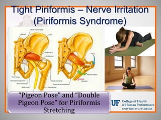 Tight Piriformis – Nerve Irritation
(Piriformis Syndrome)
“Pigeon Pose” and “Double
Pigeon Pose” for Piriformis
Stretching
 