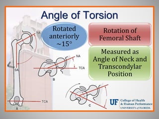 Angle of Torsion
Rotation of
Femoral Shaft
Measured as
Angle of Neck and
Transcondylar
Position
Rotated
anteriorly
~15
 