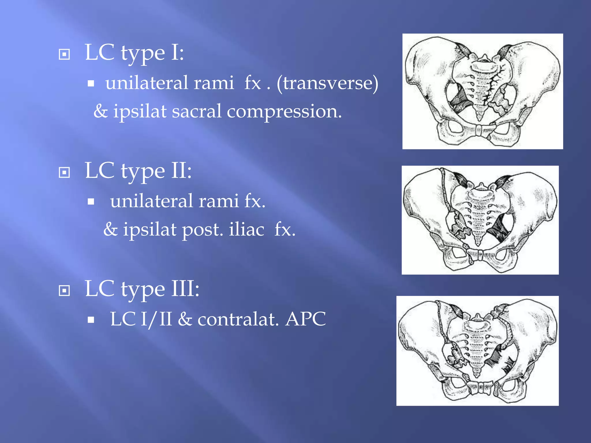 Pelvic fracture | PPTX