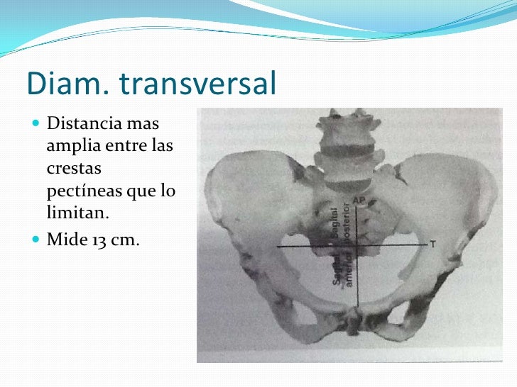 Pelvis Verdadera Y Pelvis Falsa