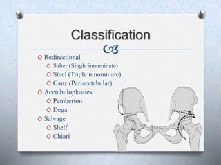 Pelvis osteotomies in ddh patients | PPTX