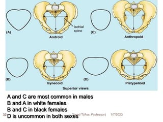 32
A and C are most common in males
B and A in white females
B and C in black females
D is uncommon in both sexes 1/7/2023
Yared T(Ass. Professor)
 