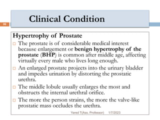 Clinical Condition
Hypertrophy of Prostate
 The prostate is of considerable medical interest
because enlargement or benign hypertrophy of the
prostate (BHP) is common after middle age, affecting
virtually every male who lives long enough.
 An enlarged prostate projects into the urinary bladder
and impedes urination by distorting the prostatic
urethra.
 The middle lobule usually enlarges the most and
obstructs the internal urethral orifice.
 The more the person strains, the more the valve-like
prostatic mass occludes the urethra.
1/7/2023
Yared T(Ass. Professor)
99
 