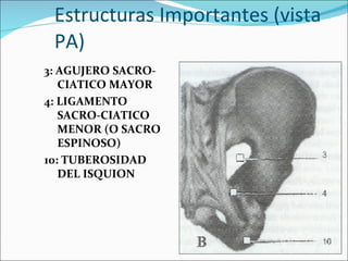 Estructuras Importantes (vista PA) 3: AGUJERO SACRO-CIATICO MAYOR 4: LIGAMENTO SACRO-CIATICO MENOR (O SACRO ESPINOSO)  10: TUBEROSIDAD DEL ISQUION 