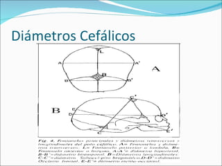 Diámetros Cefálicos 