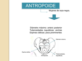 Pelvis tipos | PPTX