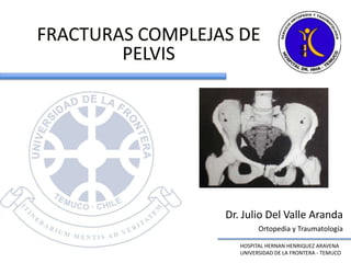 FRACTURAS COMPLEJAS DE PELVIS Dr. Julio Del Valle Aranda Ortopedia y Traumatología HOSPITAL HERNAN HENRIQUEZ ARAVENA UNIVERSIDAD DE LA FRONTERA - TEMUCO 