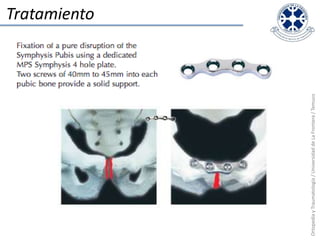 TratamientoOrtopedia y Traumatología / Universidad de La Frontera / Temuco