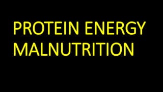 PROTEIN ENERGY
MALNUTRITION
 